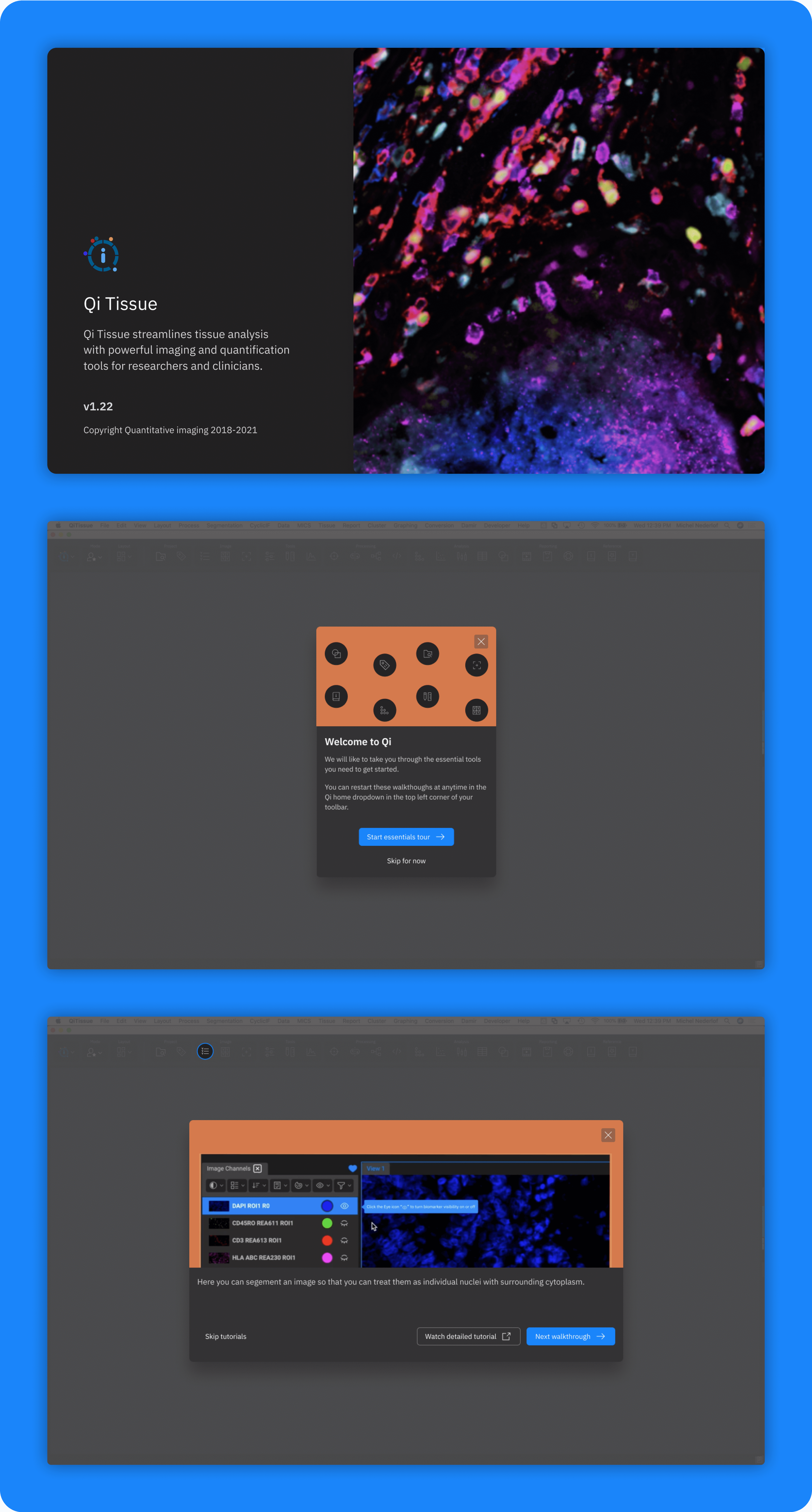 Onboarding